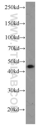 DUSP9 Antibody in Western Blot (WB)