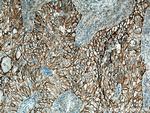 ICAM-1 Antibody in Immunohistochemistry (Paraffin) (IHC (P))