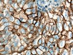ICAM-1 Antibody in Immunohistochemistry (Paraffin) (IHC (P))