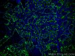 ICAM-1 Antibody in Immunohistochemistry (PFA fixed) (IHC (PFA))
