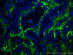 ICAM-1 Antibody in Immunohistochemistry (PFA fixed) (IHC (PFA))