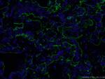 ICAM-1 Antibody in Immunohistochemistry (PFA fixed) (IHC (PFA))