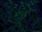 ICAM-1 Antibody in Immunohistochemistry (PFA fixed) (IHC (PFA))