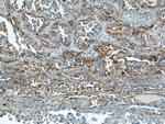 ICAM-1 Antibody in Immunohistochemistry (Paraffin) (IHC (P))