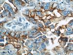 ICAM-1 Antibody in Immunohistochemistry (Paraffin) (IHC (P))