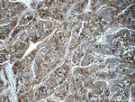 ICAM-1 Antibody in Immunohistochemistry (Paraffin) (IHC (P))