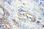 ICAM-1 Antibody in Immunohistochemistry (Paraffin) (IHC (P))