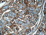 ICAM-1 Antibody in Immunohistochemistry (Paraffin) (IHC (P))