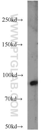 ICAM-1 Antibody in Western Blot (WB)