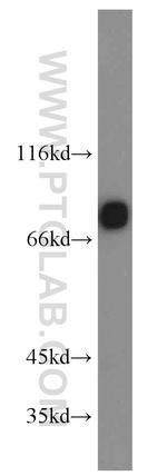 ICAM-1 Antibody in Western Blot (WB)