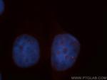 BMI1 Antibody in Immunocytochemistry (ICC/IF)