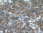 EPHX2 Antibody in Immunohistochemistry (Paraffin) (IHC (P))