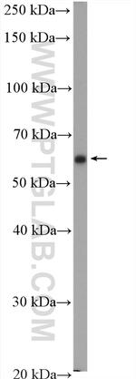 EPHX2 Antibody in Western Blot (WB)