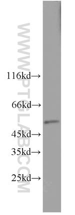 TADA3L Antibody in Western Blot (WB)
