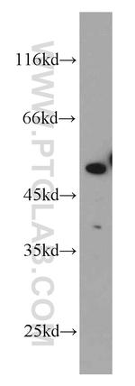 TADA3L Antibody in Western Blot (WB)