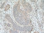 RAP1B Antibody in Immunohistochemistry (Paraffin) (IHC (P))