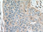 RAP1B Antibody in Immunohistochemistry (Paraffin) (IHC (P))