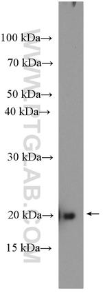 RAP1B Antibody in Western Blot (WB)