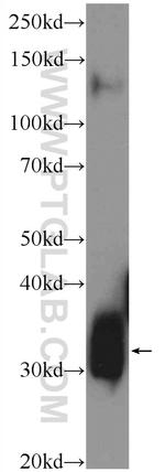 Syntaxin 6 Antibody in Western Blot (WB)