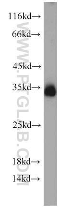 Syntaxin 6 Antibody in Western Blot (WB)