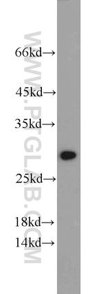 ANP32B Antibody in Western Blot (WB)