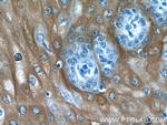 IL1RA Antibody in Immunohistochemistry (Paraffin) (IHC (P))