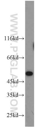 MST4 Antibody in Western Blot (WB)