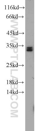 HNRNPA0 Antibody in Western Blot (WB)