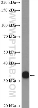 HNRNPA0 Antibody in Western Blot (WB)