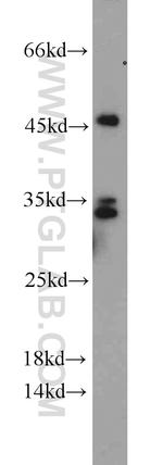HNRNPA0 Antibody in Western Blot (WB)