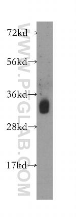 HNRNPA0 Antibody in Western Blot (WB)