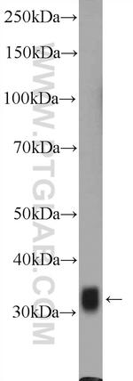 HNRNPA0 Antibody in Western Blot (WB)