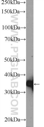 HNRNPA0 Antibody in Western Blot (WB)