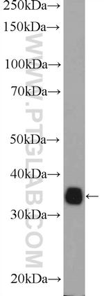 HNRNPA0 Antibody in Western Blot (WB)