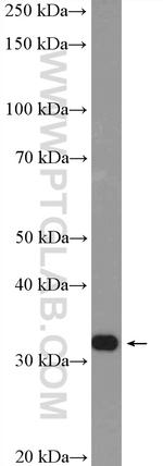HNRNPA0 Antibody in Western Blot (WB)