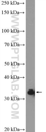 HNRNPA0 Antibody in Western Blot (WB)