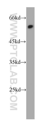 TRIM11 Antibody in Western Blot (WB)