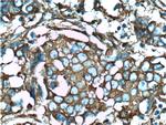 CLTA Antibody in Immunohistochemistry (Paraffin) (IHC (P))