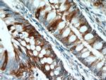 Palladin Antibody in Immunohistochemistry (Paraffin) (IHC (P))