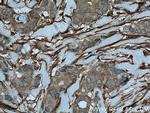 Palladin Antibody in Immunohistochemistry (Paraffin) (IHC (P))
