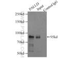 Palladin Antibody in Immunoprecipitation (IP)