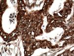 BLNK Antibody in Immunohistochemistry (Paraffin) (IHC (P))