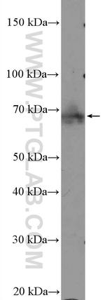 BLNK Antibody in Western Blot (WB)