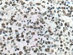 Histone H2A.X Antibody in Immunohistochemistry (Paraffin) (IHC (P))