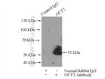 OCT2 Antibody in Immunoprecipitation (IP)