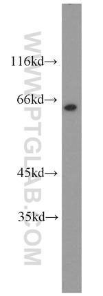 OCT2 Antibody in Western Blot (WB)