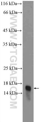 ARMET Antibody in Western Blot (WB)