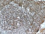 FBXO5 Antibody in Immunohistochemistry (Paraffin) (IHC (P))