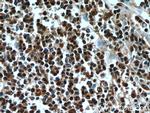 FBXO5 Antibody in Immunohistochemistry (Paraffin) (IHC (P))