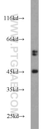 FBXO5 Antibody in Western Blot (WB)